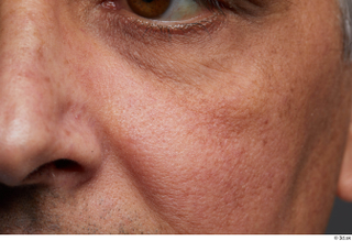 HD Face Skin Reuben Panjaitan cheek face nose skin pores…